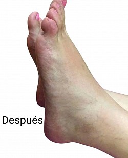 Sesión de reflexología podal - Después