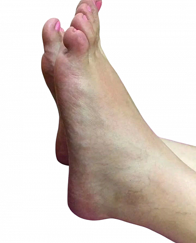 Sesión de reflexología podal